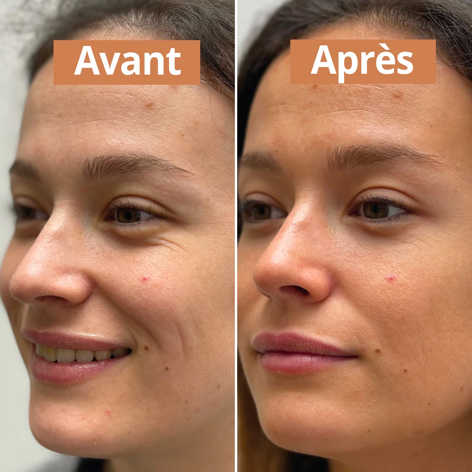 Comme Avant - Sérum auto-bronzant – Image 3